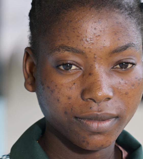 a pathway out of poverty in Zambia